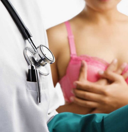 prevencion del cancer de mama